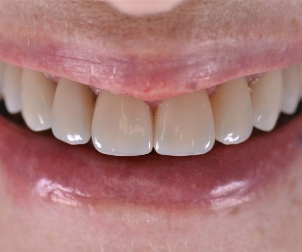 Cópia de reabilitação oral final