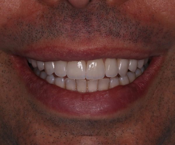 Cópia de samuel repouso (2)